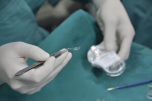 cataract symptoms and treatment, imported intraocular lens,intraocular lens, cataract